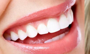 イメージを左右する前歯の歯の角度