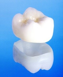 ジルコニアは金属を使わない歯の素材の中では、現在最も硬く安定性の高い素材です。