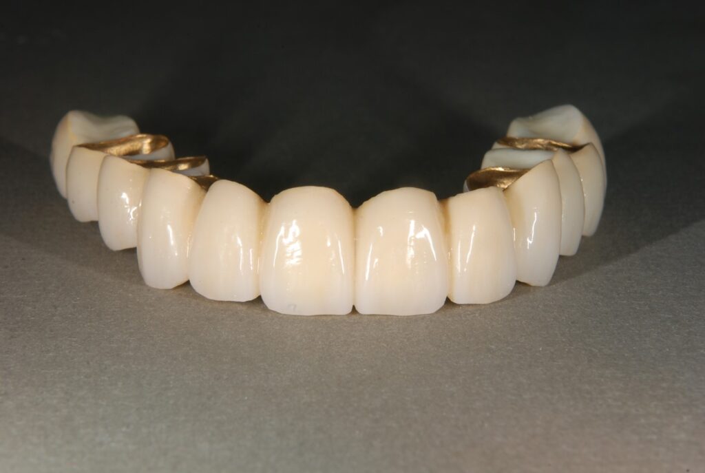 【歯科医が徹底紹介】入れ歯・義歯の代表的7種類とその特徴