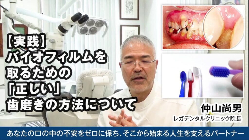 [動画]バイオフィルムを取る「正しい」歯磨きの方法