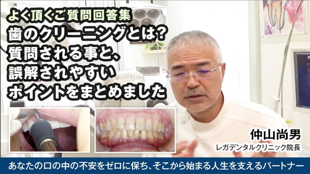 [動画]歯のクリーニングとは？よく誤解されやすいポイントをまとめました