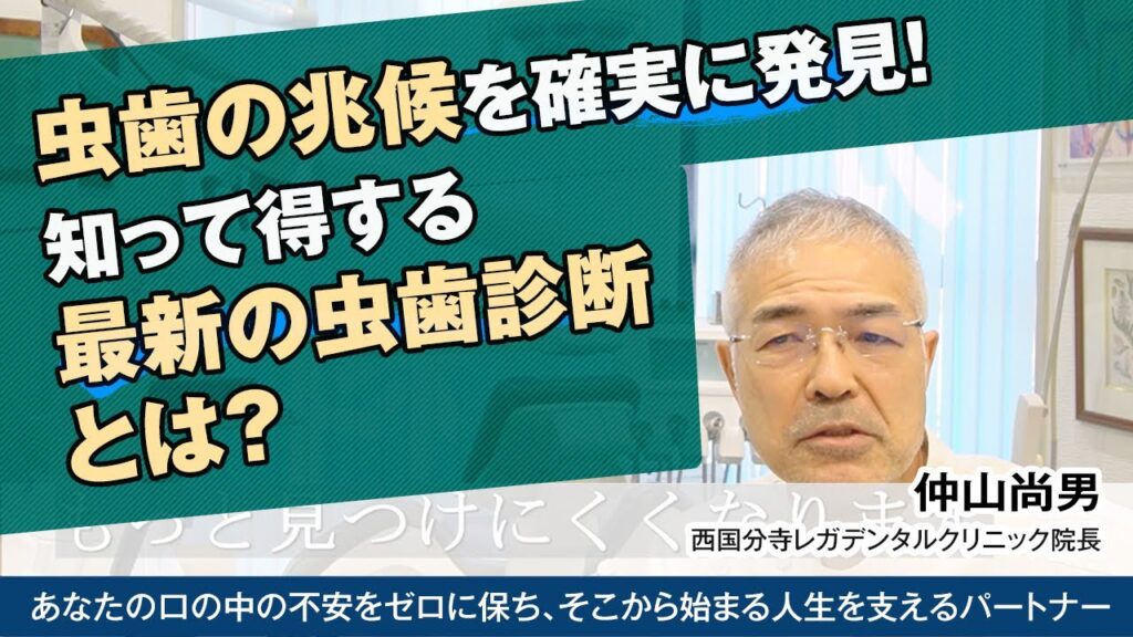 [動画]虫歯の兆候を確実に発見！知って得する最新の虫歯診断とは？